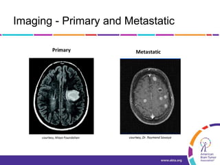 Imaging - Primary and Metastatic
 
