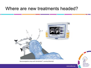 Where are new treatments headed?
Neuronavigation setup with VarioGuide™, courtesy BrainLab
 