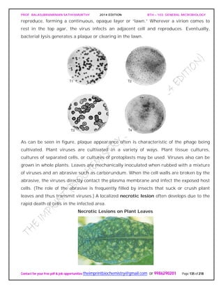 PROF. BALASUBRAMANIAN SATHYAMURTHY 2014 EDITION BTH – 103: GENERAL MICROBIOLOGY
Contact for your free pdf & job opportunities theimprintbiochemistry@gmail.com or 9986290201 Page 135 of 218
reproduce, forming a continuous, opaque layer or “lawn.” Wherever a virion comes to
rest in the top agar, the virus infects an adjacent cell and reproduces. Eventually,
bacterial lysis generates a plaque or clearing in the lawn.
As can be seen in figure, plaque appearance often is characteristic of the phage being
cultivated. Plant viruses are cultivated in a variety of ways. Plant tissue cultures,
cultures of separated cells, or cultures of protoplasts may be used. Viruses also can be
grown in whole plants. Leaves are mechanically inoculated when rubbed with a mixture
of viruses and an abrasive such as carborundum. When the cell walls are broken by the
abrasive, the viruses directly contact the plasma membrane and infect the exposed host
cells. (The role of the abrasive is frequently filled by insects that suck or crush plant
leaves and thus transmit viruses.) A localized necrotic lesion often develops due to the
rapid death of cells in the infected area.
Necrotic Lesions on Plant Leaves
 