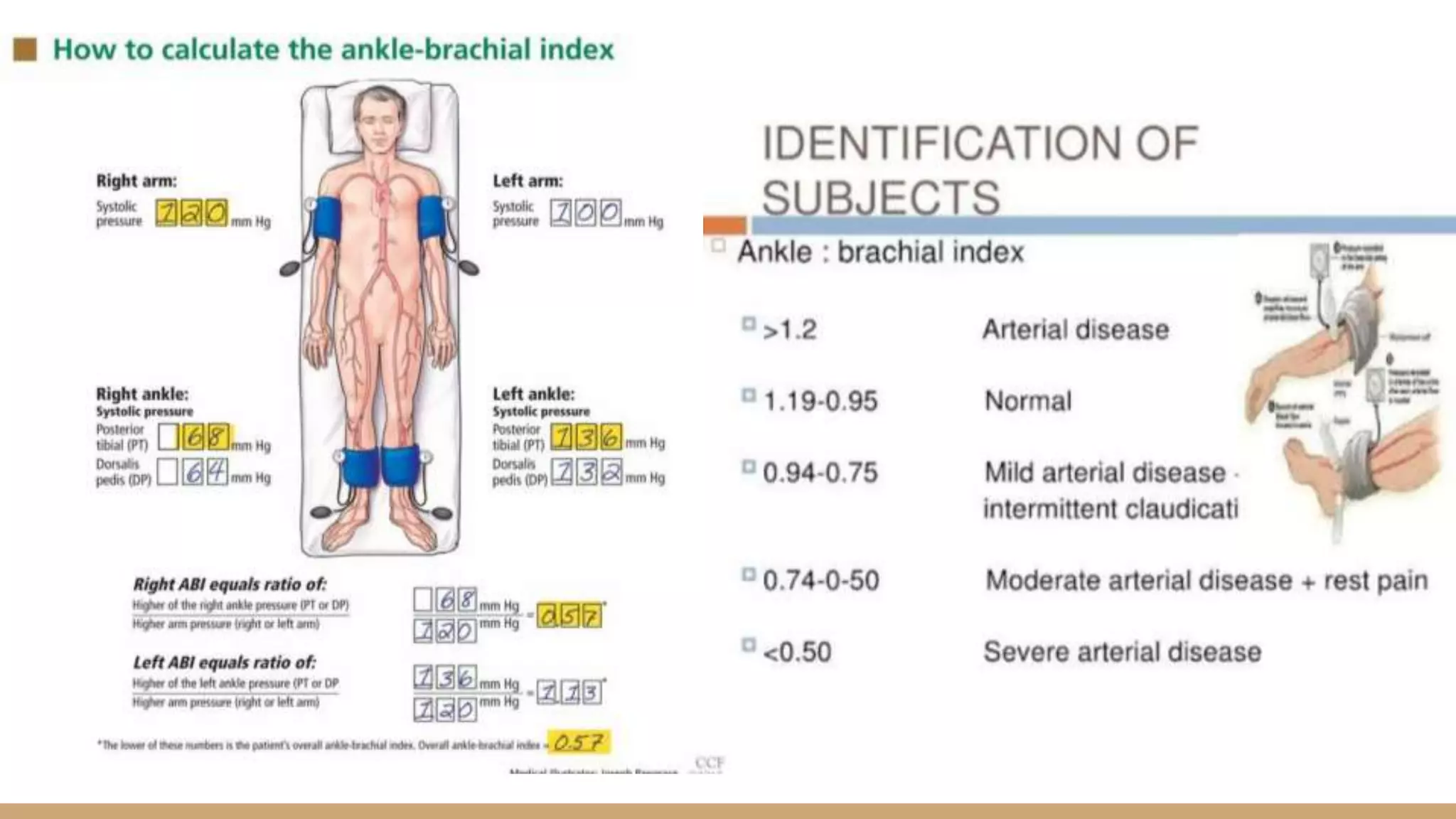 Evaluation and Management Peripheral vascular injury | PPTX