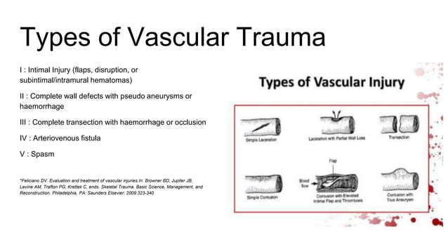 Evaluation and Management Peripheral vascular injury | PPTX | First Aid ...