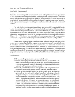 Destrezas en el Manejo de la Vía Aérea 97
Intubación Nasotraqueal
Sejustificalavíanasotraquealdelaintubaciónenlaescenaprehospitalariacuandonosepuedeabrir
labocadelpacienteadultoporquelamandíbulaestárígidaycuandonopuedeseventilaralpaciente
de otra manera. La gran desventaja de este método es su dificultad relativa porque depende de la
apreciacióndelaintensidaddelosruidosrespiratoriosdurantelarespiraciónespontáneadelpacien-
te.Esunprocedimientoaciegasycomotalrequiereunesfuerzoadicionallacolocaciónintratraqueal
del tubo.
Para guiar el tubo a través de la abertura glótica se tiene que percibir la intensidad del sonido
delairedurantelaexhalacióndelpaciente.Conciertadificultad,sepuedeguiareltubohaciaelpunto
de máxima intensidad y deslizarlo a través de las cuerdas. Se puede oír y sentir mucho mejor los
ruidos respiratorios colocando la oreja sobre el orificio proximal del tubo. En la actualidad existen
adaptadores comerciales para hacer esto sin riesgo de contaminación personal o del equipo (ver
Figura 5-4a y 5-4b). Si no se tiene uno de éstos a la mano, se puede retirar la campana de un
estetoscopio y luego insertar sólo la manguera dentro del tubo endotraqueal (ver Figura 5-4c).
El éxito de este método dependerá también de que el tubo tenga una curvatura anterior que
evitará su paso por el esófago. Se deben preparar dos tubos antes de intentar la intubación. Insertar
la punta distal de un tubo de 7mm dentro de su punta proximal, y así se moldeará a la forma de un
circulo. La preparación de dos tubos permite el uso inmediato del segundo más rígido, ya que el
primertubosecalentaráconlatemperaturacorporalyperderásucurvaturaanterior.Eldesplazamiento
delalenguaylamandíbulahaciaadelantetambiénpuedeserútilparalograrunabuenacolocación,
yaqueestamaniobralevantalaepiglotishaciaadelantefueradelcaminodeltuboqueestáavanzando.
Procedimiento
1. Llevar a cabo los procedimientos de preparación de rutina.
2.Lubricarelgloboylapuntadistaldeuntuboendotraquealde7.0o7.5mm.Con
elbiselcontraelpisooeltabiquedelacavidadnasal,sedeslizaeltubodistalmente
a través de la narina más grande. Se desliza sobre el piso de la cavidad nasal (a
un ángulo de 90 grados en relación con la cara).
3. Cuando la punta del tubo alcance la pared posterior de la faringe, tener mucho
cuidadode“tomarlacurva”yluegodirigireltubohacialaaberturaglótica.
4.Al observar la prominencia laríngea del cuello se puede juzgar la colocación
aproximada del tubo; la elevación de la piel en cualquier lado de la prominencia
laríngeaindicaráqueeltubosehaatoradoenlafosapiriforme,unproblemaque
se resuelve retirando ligeramente y girando el tubo hacia la línea media. Si se
mueveosedesplazalaprominencialaríngeausualmenteindicaráqueeltuboha
entrado en la abertura glótica y se ha colocado de manera correcta. En este
punto,elpaciente,especialmentesinoestáencomaprofundo,toserá,sequejará,
oambos.Estopuedealarmaralintubadorinexpertoquienpuedeinterpretaresto
como un laringoespasmo o mala colocación del tubo. La tendencia puede ser
jalar(halar)eltuboyventilar,yaqueelpacientepuedenorespirarinmediatamente.
 