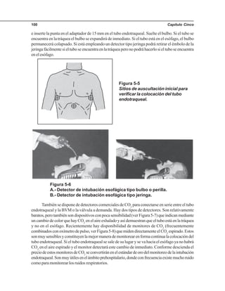Capítulo Cinco100
e inserte la punta en el adaptador de 15 mm en el tubo endotraqueal. Suelte el bulbo. Si el tubo se
encuentra en la tráquea el bulbo se expandirá de inmediato. Si el tubo está en el esófago, el bulbo
permanecerá colapsado. Si está empleando un detector tipo jeringa podrá retirar el émbolo de la
jeringafácilmentesieltuboseencuentraenlatráqueaperonopodráhacerlosieltuboseencuentra
en el esófago.
Figura 5-5
Sitios de auscultación inicial para
verificar la colocación del tubo
endotraqueal.
Figura 5-6
A.- Detector de intubación esofágica tipo bulbo o perilla.
B.- Detector de intubación esofágica tipo jeringa.
También se dispone de detectores comerciales de CO2
para conectarse en serie entre el tubo
endotraqueal y la BVM o la válvula a demanda. Hay dos tipos de detectores. Son relativamente
baratos,perotambiénsondispositivosconpocasensibilidad(verFigura5-7)queindicanmediante
un cambio de color que hay CO2
en el aire exhalado y así demuestran que el tubo está en la tráquea
y no en el esófago. Recientemente hay disponibilidad de monitores de CO2
(frecuentemente
combinadosconoxímetrodepulso,verFigura5-8)quemidendirectamenteelCO2
espirado.Estos
sonmuysensiblesyconstituyenlamejormanerademonitorearenformacontinualacolocacióndel
tubo endotraqueal. Si el tubo endotraqueal se sale de su lugar y se va hacia el esófago ya no habrá
CO2
en el aire espirado y el monitor detectará este cambio de inmediato. Conforme descienda el
preciodeestosmonitoresdeCO2
seconvertiránenelestándardeorodelmonitoreodelaintubación
endotraqueal.Sonmuyútilesenelámbitoprehospitalario,dondeconfrecuenciaexistemuchoruido
como para monitorear los ruidos respiratorios.
 