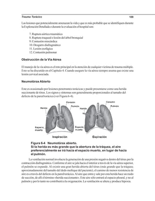 Trauma Torácico 109
Laslesionesquepotencialmenteamenazanlavidayqueesmásprobablequeseidentifiquendurante
laExploraciónDetalladaodurantelaevaluaciónelhospitalson:
7.Rupturaaórticatraumática
8. Ruptura traqueal o lesión del árbol bronquial
9.Contusiónmiocárdica
10.Desgarrodiafragmático
11.Lesiónesofágica
12.Contusiónpulmonar
Obstrucción de la Vía Aérea
Elmanejodelavíaaéreaeselretoprincipalenlaatencióndecualquiervíctimadetraumamúltiple.
Esto se ha discutido en el Capítulo 4. Cuando asegure la vía aérea siempre asuma que existe una
lesióncervicalasociada.
Neumotórax Abierto
Este es ocasionado por lesiones penetrantes torácicas y puede presentarse como una herida
succionante de tórax. Los signos y síntomas son generalmente proporcionales al tamaño del
defecto de la pared torácica (ver Figura 6-4).
Figura 6-4 Neumotórax abierto.
Si la herida es más grande que la abertura de la tráquea, el aire
preferencialmente se irá hacia el espacio muerto, en lugar de hacia
el pulmón.
Laventilaciónnormalinvolucralageneracióndeunapresiónnegativadentrodeltóraxporla
contraccióndiafragmática.Conformeelairesejalahaciaelinterioratravésdelavíaaéreasuperior,
el pulmón se expande. Al existir una gran herida abierta del tórax (más grande que la tráquea;
aproximadamente del tamaño del dedo meñique del paciente), el camino de menor resistencia de
aireesatravésdeldefectoenlaparedtorácica.Alairequeentraysaleporestaheridahaceunruido
de succión, de allí el término «herida succionante». Este aire sólo entrará al espacio pleural, y no al
pulmón y por lo tanto no contribuirá a la oxigenación. La ventilación se altera y produce hipoxia.
 