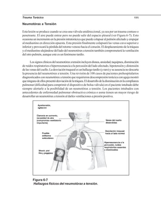 Trauma Torácico 111
Neumotórax a Tensión
Esta lesión se produce cuando se crea una válvula unidireccional, ya sea por un trauma contuso o
penetrante. El aire puede entrar pero no puede salir del espacio pleural (ver Figura 6-7). Esto
ocasionaunincrementoenlapresiónintratorácicaquepuedecolapsaralpulmónafectadoyempujar
al mediastino en dirección opuesta. Esta presión finalmente colapsará las venas cava superior e
inferioryprovocarálapérdidadelretornovenosohaciaelcorazón.Eldesplazamientodelatráquea
yelmediastinoalejándosedelladodelneumotóraxatensióntambiéncomprometerálaventilación
del otro pulmón, aunque este es un fenómeno tardío.
Lossignosclínicosdelneumotóraxatensiónincluyendisnea,ansiedad,taquipnea,disminución
de ruidos respiratorios e hiperresonancia a la percusión del lado afectado, hipotensión y distensión
delasvenasdelcuello.Ladesviacióntraquealesunhallazgotardío(yraro)ysuausencianodescarta
la presencia del neumotórax a tensión. Una revisión de 108 casos de pacientes prehospitalarios
diagnosticadosconneumotóraxatensiónquerequirierondescompresióntorácicaconagujamostró
queningunodeellospresentódesviacióndelatráquea.Eldesarrollodeladisminuciónenlacomplianza
pulmonar (dificultad para comprimir el dispositivo de bolsa-válvula) en el paciente intubado debe
siempre alertarle a la posibilidad de un neumotórax a tensión. Los pacientes intubados con
antecedentes de enfermedad pulmonar obstructiva crónica o asma tienen un mayor riesgo de
desarrollarunneumotóraxatensiónaldarlesventilacionesapresiónpositiva.
Figura 6-7
Hallazgos físicos del neumotórax a tensión.
 