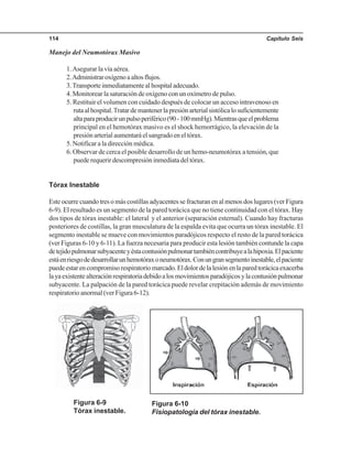 Capítulo Seis114
Manejo del Neumotórax Masivo
1.Asegurar la vía aérea.
2.Administraroxígenoaaltosflujos.
3.Transporteinmediatamentealhospitaladecuado.
4. Monitorear la saturación de oxígeno con un oxímetro de pulso.
5. Restituir el volumen con cuidado después de colocar un acceso intravenoso en
rutaalhospital.Tratardemantenerlapresiónarterialsistólicalosuficientemente
altaparaproducirunpulsoperiférico(90-100mmHg).Mientrasqueelproblema
principal en el hemotórax masivo es el shock hemorrágico, la elevación de la
presión arterial aumentará el sangrado en el tórax.
5. Notificar a la dirección médica.
6. Observar de cerca el posible desarrollo de un hemo-neumotórax a tensión, que
puede requerir descompresión inmediata del tórax.
Tórax Inestable
Este ocurre cuando tres o más costillas adyacentes se fracturan en al menos dos lugares (ver Figura
6-9). El resultado es un segmento de la pared torácica que no tiene continuidad con el tórax. Hay
dos tipos de tórax inestable: el lateral y el anterior (separación esternal). Cuando hay fracturas
posteriores de costillas, la gran musculatura de la espalda evita que ocurra un tórax inestable. El
segmento inestable se mueve con movimientos paradójicos respecto el resto de la pared torácica
(ver Figuras 6-10 y 6-11). La fuerza necesaria para producir esta lesión también contunde la capa
detejidopulmonarsubyacenteyéstacontusiónpulmonartambiéncontribuyealahipoxia.Elpaciente
estáenriesgodedesarrollarunhemotóraxoneumotórax.Conungransegmentoinestable,elpaciente
puedeestarencompromisorespiratoriomarcado.Eldolordelalesiónenlaparedtorácicaexacerba
layaexistentealteraciónrespiratoriadebidoalosmovimientosparadójicosylacontusiónpulmonar
subyacente. La palpación de la pared torácica puede revelar crepitación además de movimiento
respiratorio anormal (ver Figura 6-12).
Figura 6-9
Tórax inestable.
Figura 6-10
Fisiopatología del tórax inestable.
 