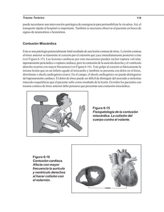 Trauma Torácico 119
puedenecesitarseunaintervenciónquirúrgicadeemergenciaparapermeabilizarlavíaaérea.Así,el
transporte rápido al hospital es importante.También es necesario observar al paciente en busca de
signosdeneumotóraxohemotórax.
Contusión Miocárdica
Estaesunapatologíapotencialmenteletalresultadodeunalesióncontusadetórax.Lalesióncontusa
al tórax anterior se transmite al corazón por el esternón que yace inmediatamente posterior a éste
(ver Figura 6-15). Las lesiones cardiacas por este mecanismo pueden incluir ruptura valvular,
taponamientopericárdicoorupturacardiaca,perolacontusióndelaaurículaderechayelventrículo
derecho ocurren con mayor frecuencia (ver Figura 6-16) . Este golpe al corazón es básicamente la
misma lesión que en un infarto agudo al miocardio y también se presenta con dolor en el tórax,
disrritmias o shock cardiogénico (raro). En el campo, el shock cardiogénico no puede distinguirse
deltaponamientocardiaco.Eldolordetóraxpuedeserdifícildedistinguirdelasociadoamolestias
músculo-esqueléticas que el paciente sufre como resultado de la lesión. En todos los pacientes con
trauma contuso de tórax anterior debe pensarse que presentan una contusión miocárdica.
Figura 6-15
Fisiopatología de la contusión
miocárdica. La colisión del
cuerpo contra el volante.
Figura 6-16
Contusión cardiaca.
Afecta con mayor
frecuencia la aurícula
y ventriculo derechos
al hacer colisión con
el esternón.
 
