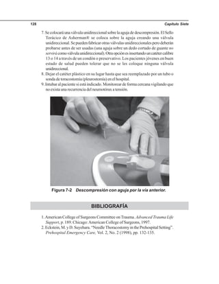 Capítulo Siete128
7.Secolocaráunaválvulaunidireccionalsobrelaagujadedescompresión.ElSello
Torácico de Asherman® se coloca sobre la aguja creando una válvula
unidireccional.Sepuedenfabricarotrasválvulasunidireccionalesperodeberán
probarse antes de ser usadas (una aguja sobre un dedo cortado de guante no
servirácomoválvulaunidireccional).Otraopciónesinsertandouncatétercalibre
13 o 14 a través de un condón o preservativo. Los pacientes jóvenes en buen
estado de salud pueden tolerar que no se les coloque ninguna válvula
unidireccional.
8. Dejar el catéter plástico en su lugar hasta que sea reemplazado por un tubo o
sonda de toracostomía (pleurostomía) en el hospital.
9. Intubar al paciente si está indicado. Monitorear de forma cercana vigilando que
noexistaunarecurrenciadelneumotóraxatensión.
Figura 7-2 Descompresión con aguja por la vía anterior.
BIBLIOGRAFÍA
1.American College of Surgeons Committee on Trauma. Advanced Trauma Life
Support, p. 189. Chicago:American College of Surgeons, 1997.
2. Eckstein, M. y D. Suyehara. “Needle Thoracostomy in the Prehospital Setting”.
Prehospital Emergency Care, Vol. 2, No. 2 (1998), pp. 132-135.
 