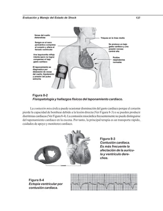 Evaluación y Manejo del Estado de Shock 137
La contusión miocárdicapuede ocasionar disminución del gasto cardiaco porque el corazón
pierde la capacidad de bombear debido a la lesión directa (Ver Figura 8-3) o se pueden producir
disrritmiascardiacas(VerFigura8-4).Lacontusiónmiocárdicafrecuentementenopuededistinguirse
del taponamiento cardiaco en la escena. Por tanto, la principal terapia es un transporte rápido,
cuidados de apoyo y monitoreo cardiaco.
Figura 8-2
Fisiopatología y hallazgos físicos del taponamiento cardiaco.
Figura 8-4
Ectopia ventricular por
contusión cardiaca.
Figura 8-3
Contusión cardiaca.
Es más frecuente la
afectación de la aurícu-
la y ventrículo dere-
chos.
 