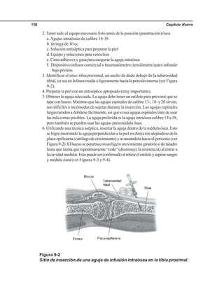 Capítulo Nueve150
2. Tener todo el equipo necesario listo antes de la punción (penetración) ósea.
a.Agujas intraóseas de calibre 16-18
b. Jeringa de 10 cc
c. Solución antiséptica para preparar la piel
d.Equipoysolucionesparavenoclisis
e. Cinta adhesiva y gasa para asegurar la aguja intraósea
f. Dispositivo infusor comercial o baumanómetro (tensiómetro) para infundir
bajo presión
3. Identificar el sitio: tibia proximal, un ancho de dedo debajo de la tuberosidad
tibial,yaseaenlalíneamediaoligeramentehacialaporcióninterna(verFigura
9-2).
4. Preparar la piel con un antiséptico apropiado (muy importante).
5. Obtener la aguja adecuada. La aguja debe tener un estilete para prevenir que se
tapeconhueso.Mientrasquelasagujasespinalesdecalibre13-,18-y20sirven,
son difíciles e incómodas de sujetar durante la inserción. Las agujas espinales
largas tienden a doblarse fácilmente, así que si usa agujas espinales trate de usar
las más cortas posibles. La aguja preferida es la aguja intraósea calibre 14 a 18,
pero también se pueden usar las agujas para médula ósea.
6. Utilizando una técnica aséptica, insertar la aguja dentro de la médula ósea. Esto
se logra insertando la aguja perpendicular a la piel en dirección alejándose de la
placa epifisiaria (cartílago de crecimiento) y avanzándola hacia el periostio (ver
Figura9-2).Elhuesosepenetraconunligeromovimientogiratorioodetaladro
hastaquesientaquerepentinamente“cede”(disminuyelaresistencia)alentrara
lacavidadmedular.Estopuedeserconfirmadoalretirarelestileteyaspirarsangre
y médula ósea (ver Figuras 9-3 y 9-4).
Figura 9-2
Sitio de inserción de una aguja de infusión intraósea en la tibia proximal.
 