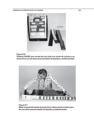 Destrezas en la Reanimación con Líquidos 153
Figura 9-6
Sistema SPARC que consta de una cinta con zonas de colores y un
instructivo con las dosis precalculadas de líquidos y medicamentos .
Figura 9-7
Medir al paciente desde la punta de la cabeza hasta el talón para
leer las dosis precalculadas de líquidos y medicamentos.
 