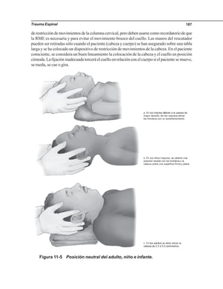 Trauma Espinal 187
derestriccióndemovimientosdelacolumnacervical,perodebenusarsecomorecordatoriodeque
la RME es necesaria y para evitar el movimiento brusco del cuello. Las manos del rescatador
pueden ser retiradas sólo cuando el paciente (cabeza y cuerpo) se han asegurado sobre una tabla
larga y se ha colocado un dispositivo de restricción de movimientos de la cabeza. En el paciente
consciente, se considera un buen lineamiento la colocación de la cabeza y el cuello en posición
cómoda. La fijación inadecuada torcerá el cuello en relación con el cuerpo si el paciente se mueve,
se rueda, se cae o gira.
Figura 11-5 Posición neutral del adulto, niño e infante.
 
