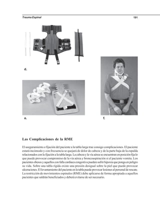 Trauma Espinal 191
d.
f.e.
Las Complicaciones de la RME
El aseguramiento o fijación del paciente a la tabla larga trae consigo complicaciones. El paciente
estará incómodo y con frecuencia se quejará de dolor de cabeza y de la parte baja de la espalda
relacionadosconlafijaciónalatablalarga.Lacabezaylavíaaéreaseencuentranenposiciónfijalo
que puede provocar compromiso de la vía aérea y broncoaspiración si el paciente vomita. Los
pacientesobesosyaquellosconfallacardiacacongestivapuedensufrirhipoxiaquepongaenpeligro
su vida. Sobre una tabla rígida existe una presión desigual sobre la piel que puede provocar
ulceraciones.Ellevantamientodelpacienteenlatablapuedeprovocarlesionesalpersonalderescate.
La restricción de movimientos espinales (RME) debe aplicarse de forma apropiada a aquellos
pacientes que saldrán beneficiados y deberá evitarse de ser necesario.
 