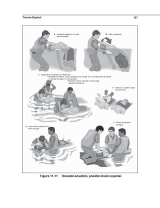 Trauma Espinal 197
Figura 11-11 Rescate acuático, posible lesión espinal.
 