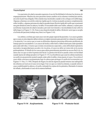 Trauma Espinal 199
Los pacientes de edad avanzada requieren el uso de flexibilidad al efectuar las técnicas de
empaquetamiento. Muchos de estos pacientes tienen cambios en la columna vertebral por artritis,
asícomolapielmuydelgada.Ellosestaránmuyincómodoscuandoselescoloqueenlatablalarga.
Algunas columnas con artritis están tan rígidas que la víctima no puede acostarse completamente
sobre la tabla, y algunas personas de edad avanzada tienen flexión rígida del cuello que ocasionará
una gran distancia entre la cabeza y la tabla. El rescatador debe usar toallas, sabanas y cojines para
acolchonar al paciente de edad avanzada y prevenir movimiento e incomodidad al estar sobre la
tabla larga (ver Figura 11-14). Esta es una situación donde la tabla o férula de vacío (que se acopla
a la forma del paciente) trabaja muy bien (ver Figura 11-6).
Losatletasyciclistasqueusancascosonotrogrupoespecialdepacientes.Loscascosgrandes
queseusanenestosdeportesdebenretirarseenalgúnmomentoparapermitirlaevaluacióncompleta
y la atención. Los cascos que se usan en diferentes deportes presentan diferentes problemas de
manejo para los rescatadores. Los cascos de hockey sobre hielo o futbol americano están ajustados
para cada individuo.Amenos que existan circunstancias especiales, como dificultad respiratoria
asociada a incapacidad para acceder a la vía aérea, el casco no debe ser removido en la escena
prehospitalaria. El diseño de los cascos para atleta generalmente permitirá un acceso fácil a la vía
aérea una vez que se retira la protección facial. La protección facial se puede cortar con facilidad
usando tijeras de trabajo pesado (ver Figura 11-15). Las hombreras que usan los atletas mantienen
su cuello en una posición neutral cuando están sobre la tabla y tiene puesto el casco. Si se retira el
casco debe colocarse acojinamiento bajo la cabeza para proteger el cuello de la extensión (ver
Figuras 11-16a y 11-16b). Después de llegar a la sala de urgencias puede tomarse una radiografía
de columna cervical con el casco en su lugar. Una vez que se evaluó la columna, se puede retirar el
casco estabilizando la cabeza y el cuello, retirando los cojines de los pómulos, liberando el sistema
de inflado y deslizando el casco de la manera habitual.
Figura 11-14 Acojinamiento. Figura 11-15 Protector facial.
 