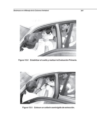 Destrezas en el Manejo de la Columna Vertebral 207
Figura 12-2 Estabilizar el cuello y realizar la Evaluación Primaria.
Figura 12-3 Colocar un collarín semirrígido de extracción.
 