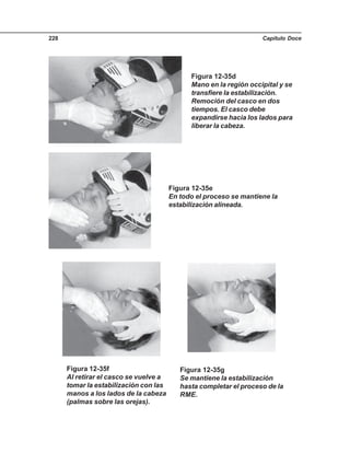 Capítulo Doce228
Figura 12-35d
Mano en la región occipital y se
transfiere la estabilización.
Remoción del casco en dos
tiempos. El casco debe
expandirse hacia los lados para
liberar la cabeza.
Figura 12-35e
En todo el proceso se mantiene la
estabilización alineada.
Figura 12-35f
Al retirar el casco se vuelve a
tomar la estabilización con las
manos a los lados de la cabeza
(palmas sobre las orejas).
Figura 12-35g
Se mantiene la estabilización
hasta completar el proceso de la
RME.
 