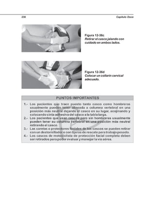 Capítulo Doce230
Figura 12-36c
Retirar el casco jalando con
cuidado en ambos lados.
Figura 12-36d
Colocar un collarín cervical
adecuado.
 