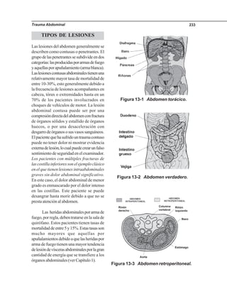 Trauma Abdominal 233
TIPOS DE LESIONES
Las lesiones del abdomen generalmente se
describen como contusas o penetrantes. El
grupodelaspenetrantessesubdivideendos
categorías:lasproducidasporarmasdefuego
yaquellasporapuñalamiento(armablanca).
Laslesionescontusasabdominalestienenuna
relativamente mayor tasa de mortalidad de
entre 10-30%, esto generalmente debido a
la frecuencia de lesiones acompañantes en
cabeza, tórax o extremidades hasta en un
70% de los pacientes involucrados en
choques de vehículos de motor. La lesión
abdominal contusa puede ser por una
compresióndirectadelabdomenconfractura
de órganos sólidos y estallido de órganos
huecos, o por una desaceleración con
desgarrodeórganososusvasossanguíneos.
Elpacientequehasufridountraumacontuso
puede no tener dolor ni mostrar evidencia
externadelesión,locualpuedecrearunfalso
sentimiento de seguridad en el examinador.
Los pacientes con múltiples fracturas de
lascostillainferioressonelejemploclásico
en el que tienen lesiones intraabdominales
graves sin dolor abdominal significativo.
En este caso, el dolor abdominal de menor
grado es enmascarado por el dolor intenso
en las costillas. Este paciente se puede
desangrar hasta morir debido a que no se
presta atención al abdomen.
Las heridasabdominalesporarmade
fuego, por regla, deben tratarse en la sala de
quirófano. Estos pacientes tienen tasas de
mortalidaddeentre5y15%.Estastasasson
mucho mayores que aquellas por
apuñalamientosdebidoaquelasheridaspor
arma de fuego tienen una mayor tendencia
delesióndevíscerasabdominalesporlagran
cantidad de energía que se transfiere a los
órganos abdominales (ver Capítulo 1).
Figura 13-1 Abdomen torácico.
Figura 13-2 Abdomen verdadero.
Figura 13-3 Abdomen retroperitoneal.
 