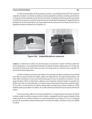 Trauma de Extremidades 251
Las fracturas bilaterales de fémur pueden asociarse a una pérdida de hasta 50% del volumen
sanguíneocirculante.Lasférulasneumáticascomolospantalonesantishocksonútilesparadisminuir
el sangrado interno alrededor de las fracturas de fémur. El pantalón antishock puede usarse junto
con la férula de tracción, en donde la presión del aire del pantalón disminuirá el sangrado interno
alrededor de la fractura de fémur (ver el procedimiento de colocación de la férula de tracción y el
pantalónneumáticoantishockenelCapítulo15).
Figura 14-8 Cabestrillo pélvico comercial.
Cadera: Las fracturas de cadera son más frecuentes en el estrecho “cuello” del fémur, donde los
fuertes ligamentos a veces pueden permitir que este tipo de fracturas soporten peso. En el tipo más
frecuente de fractura de cadera hay muy poco movimiento de los extremos óseos, aunado a la
presenciadefuertesligamentos.
Se debe considerar una fractura de cadera en los pacientes de edad avanzada que han sufrido
una caída o se quejan de dolor de rodilla, cadera o la región pélvica. Este tipo de presentación y de
dolor debe considerarse como una fractura hasta que los rayos X prueben lo contrario. En este
grupo de edad, el dolor se tolera bien y algunas veces lo ignoran y hasta lo niegan. En general, los
tejidos en la vejez son más delicados y se requiere menos fuerza para lesionar una estructura dada.
En los niños y en las personas de edad avanzada debe recordarse que el dolor aislado de rodilla
tambiénpuedeserpordañoalacadera.Nosedebeutilizarunaféruladetracciónparalafracturade
cadera.
La luxación de la cadera es una situación diferente. La mayoría de las luxaciones de cadera
resultan cuando la rodilla se impacta contra el tablero, empujando la relativamente relajada y floja
cadera fuera de su cavidad en la pelvis en su porción posterior (ver Figura 14-9).Así, a cualquier
pacientedeunaccidenteautomovilísticograveconlesiónderodilla,seledeberevisarconcuidado
la cadera.
 