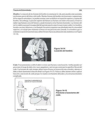 Trauma de Extremidades 255
Hombro: La mayoría de las lesiones de hombro no amenazan la vida, pero pueden estar asociadas
conlesionesgravesdeltóraxodelcuello.Muchaslesionesdelhombrosonluxacionesoseparaciones
delosespaciosarticularesysepuedenmostrarcomoundefectoenlaporciónsuperioryexternadel
hombro. Sin embargo, la porción superior del húmero se fractura con relativa frecuencia. El nervio
radialviajabastantecercadelhúmeroypuedelesionarseenlasfracturashumerales.Laslesionesdel
nervioradialocasionanlaincapacidaddelpacienteparalevantarlamano(manocaída).Loshombros
luxados son muy dolorosos y con bastante frecuencia requieren una almohada entre la extremidad
superior y el cuerpo para mantener el brazo en una posición más cómoda. Los hombros que se
sostienenenposiciónanormalnuncadebenforzarsehaciaunaalineaciónmásanatómica(verFigura
14-14).
Figura 14-14
Luxación de hombro.
Codo: Frecuentemente es difícil saber si existe una fractura o una luxación.Ambas pueden ser
gravesporelriesgodedañoalosvasossanguíneosynerviosquecorrenporlasuperficieflexoradel
codo. Las lesiones de codo siempre deben inmovilizarse en la posición más cómoda y además se
debeevaluarclaramentelafuncióndistal(verFigura14-15).Nuncasedebeintentarestiraroaplicar
tracción a una lesión de codo porque los tejidos son bastante delicados y la estructura bastante
complicada.
Figura 14-15
Fracturas o luxaciones del
codo.
 