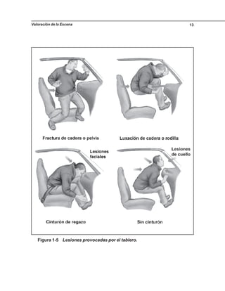 Valoración de la Escena 13
Figura 1-5 Lesiones provocadas por el tablero.
 