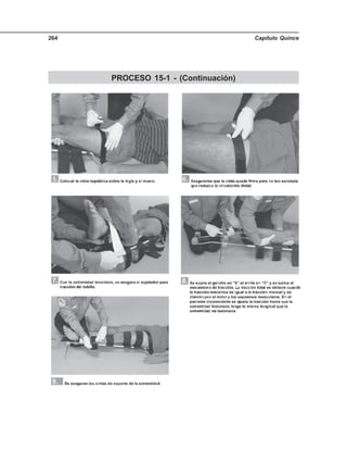 Capítulo Quince264
PROCESO 15-1 - (Continuación)
 