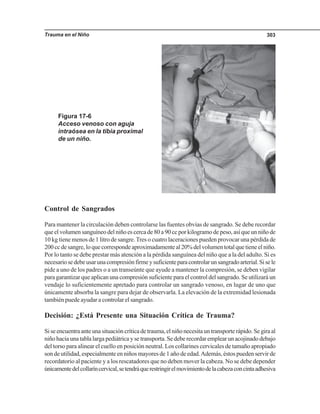 Trauma en el Niño 303
Control de Sangrados
Para mantener la circulación deben controlarse las fuentes obvias de sangrado. Se debe recordar
que el volumen sanguíneo del niño es cerca de 80 a 90 cc por kilogramo de peso, así que un niño de
10 kg tiene menos de 1 litro de sangre.Tres o cuatro laceraciones pueden provocar una pérdida de
200ccdesangre,loquecorrespondeaproximadamenteal20%delvolumentotalquetieneelniño.
Por lo tanto se debe prestar más atención a la pérdida sanguínea del niño que a la del adulto. Si es
necesariosedebeusarunacompresiónfirmeysuficienteparacontrolarunsangradoarterial.Sisele
pide a uno de los padres o a un transeúnte que ayude a mantener la compresión, se deben vigilar
para garantizar que aplican una compresión suficiente para el control del sangrado. Se utilizará un
vendaje lo suficientemente apretado para controlar un sangrado venoso, en lugar de uno que
únicamente absorba la sangre para dejar de observarla. La elevación de la extremidad lesionada
también puede ayudar a controlar el sangrado.
Decisión: ¿Está Presente una Situación Crítica de Trauma?
Si se encuentra ante una situación crítica de trauma, el niño necesita un transporte rápido. Se gira al
niño hacia una tabla larga pediátrica y se transporta. Se debe recordar emplear un acojinado debajo
del torso para alinear el cuello en posición neutral. Los collarines cervicales de tamaño apropiado
son de utilidad, especialmente en niños mayores de 1 año de edad.Además, éstos pueden servir de
recordatorio al paciente y a los rescatadores que no deben mover la cabeza. No se debe depender
únicamentedelcollaríncervical,setendráquerestringirelmovimientodelacabezaconcintaadhesiva
Figura 17-6
Acceso venoso con aguja
intraósea en la tibia proximal
de un niño.
 