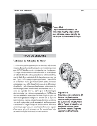 Trauma en el Embarazo 329
TIPOS DE LESIONES
Colisiones de Vehículos de Motor
Lacausamáscomúndemuertefetaleneltraumaeslamuerte
materna. Las colisiones de vehículos de motor representan
casiel65-70%delasmuertesrelacionadasconelembarazo.
En las pacientes embarazadas involucradas en un accidente
devehículodemotoresfrecuenteobservarsufrimientofetal,
muertefetal,desprendimientodelaplacenta,rupturauterina
(verFigura19-5)ytrabajodepartopretérmino.Unarevisión
de la literatura indica que menos del 1% de las pacientes
embarazadasvanasufriralgunalesiónsiexisteundañomenor
al vehículo. La lesión craneal es la causa más común de
muerte en pacientes embarazadas involucradas en CVM.
Esto es seguido muy de cerca por la hemorragia
descontrolada. Las víctimas embarazadas en CVM tienen
lesiones asociadas tales como fracturas de pelvis que con
frecuencia producen sangrados ocultos en el espacio
retroperitoneal.Lazonaretroperitoneal,debidoasusistema
venosodebajapresión,puedeacomodarlapérdidadecuatro
o más litros de sangre con pocos datos clínicos. El uso de
cinturón de seguridad con las cintas de hombro y regazo
disminuye significativamente la mortalidad sin
incrementar la frecuencia de lesiones uterinas.
Figura 19-4
La paciente embarazada se
estabiliza mejor y en posición
más cómoda en una camilla de
vacío que sobre una tabla larga.
Figura 19-5
Trauma contuso al útero. El
trauma contuso puede
causar el desprendimiento
de la placenta o ruptura del
útero. Puede producirse un
sangrado masivo, pero
puede no haber sangrado
vaginal visible al inicio.
 