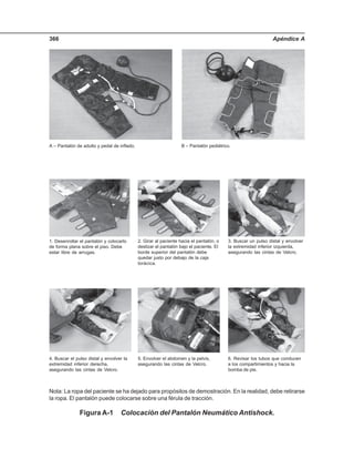 Apéndice A366
Nota: La ropa del paciente se ha dejado para propósitos de demostración. En la realidad, debe retirarse
la ropa. El pantalón puede colocarse sobre una férula de tracción.
Figura A-1 Colocación del Pantalón Neumático Antishock.
A – Pantalón de adulto y pedal de inflado. B – Pantalón pediátrico.
1. Desenrollar el pantalón y colocarlo
de forma plana sobre el piso. Debe
estar libre de arrugas.
2. Girar al paciente hacia el pantalón, o
deslizar el pantalón bajo el paciente. El
borde superior del pantalón debe
quedar justo por debajo de la caja
torácica.
3. Buscar un pulso distal y envolver
la extremidad inferior izquierda,
asegurando las cintas de Velcro.
4. Buscar el pulso distal y envolver la
extremidad inferior derecha,
asegurando las cintas de Velcro.
5. Envolver el abdomen y la pelvis,
asegurando las cintas de Velcro.
6. Revisar los tubos que conducen
a los compartimientos y hacia la
bomba de pie.
 