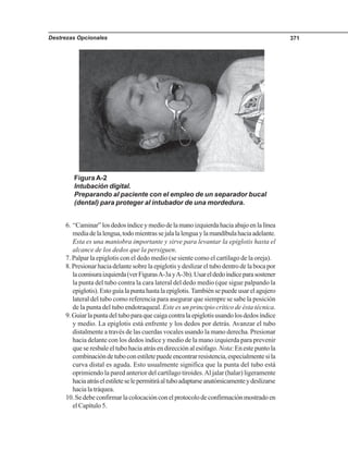 Destrezas Opcionales 371
Figura A-2
Intubación digital.
Preparando al paciente con el empleo de un separador bucal
(dental) para proteger al intubador de una mordedura.
6. “Caminar”losdedosíndiceymediodelamanoizquierdahaciaabajoenlalínea
mediadelalengua,todomientrassejalalalenguaylamandíbulahaciaadelante.
Esta es una maniobra importante y sirve para levantar la epiglotis hasta el
alcance de los dedos que la persiguen.
7. Palpar la epiglotis con el dedo medio (se siente como el cartílago de la oreja).
8. Presionar hacia delante sobre la epiglotis y deslizar el tubo dentro de la boca por
lacomisuraizquierda(verFigurasA-3ayA-3b).Usareldedoíndiceparasostener
la punta del tubo contra la cara lateral del dedo medio (que sigue palpando la
epiglotis).Estoguíalapuntahastalaepiglotis.Tambiénsepuedeusarelagujero
lateral del tubo como referencia para asegurar que siempre se sabe la posición
de la punta del tubo endotraqueal. Este es un principio crítico de ésta técnica.
9.Guiarlapuntadeltuboparaquecaigacontralaepiglotisusandolosdedosíndice
y medio. La epiglotis está enfrente y los dedos por detrás. Avanzar el tubo
distalmente a través de las cuerdas vocales usando la mano derecha. Presionar
hacia delante con los dedos índice y medio de la mano izquierda para prevenir
que se resbale el tubo hacia atrás en dirección al esófago. Nota: En este punto la
combinacióndetuboconestiletepuedeencontrarresistencia,especialmentesila
curva distal es aguda. Esto usualmente significa que la punta del tubo está
oprimiendo la pared anterior del cartílago tiroides.Al jalar (halar) ligeramente
haciaatráselestileteselepermitiráaltuboadaptarseanatómicamenteydeslizarse
hacia la tráquea.
10.Sedebeconfirmarlacolocaciónconelprotocolodeconfirmaciónmostradoen
el Capítulo 5.
 