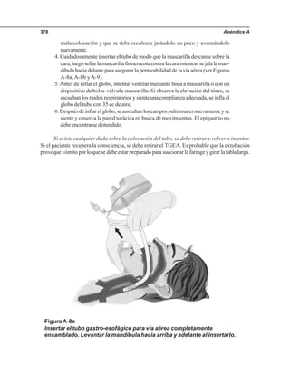 Apéndice A378
mala colocación y que se debe recolocar jalándolo un poco y avanzándolo
nuevamente.
4. Cuidadosamente insertar el tubo de modo que la mascarilla descanse sobre la
cara,luegosellarlamascarillafirmementecontralacaramientrassejalalaman-
díbula hacia delante para asegurar la permeabilidad de la vía aérea (ver Figuras
A-8a, A-8b y A-9).
5.Antes de inflar el globo, intentar ventilar mediante boca a mascarilla o con un
dispositivo de bolsa-válvula-mascarilla. Si observa la elevación del tórax, se
escuchan los ruidos respiratorios y siente una complianza adecuada, se infla el
globo del tubo con 35 cc de aire.
6.Despuésdeinflarelglobo,seauscultanloscampospulmonaresnuevamenteyse
siente y observa la pared torácica en busca de movimientos. El epigastrio no
debe encontrarse distendido.
Si existe cualquier duda sobre la colocación del tubo, se debe retirar y volver a insertar.
Si el paciente recupera la consciencia, se debe retirar el TGEA. Es probable que la extubación
provoque vómito por lo que se debe estar preparado para succionar la faringe y girar la tabla larga.
Figura A-8a
Insertar el tubo gastro-esofágico para vía aérea completamente
ensamblado. Levantar la mandíbula hacia arriba y adelante al insertarlo.
 