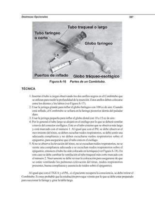 Destrezas Opcionales 387
Figura A-16 Partes de un Combitubo.
TÉCNICA
1. Insertar el tubo a ciegas observando los dos anillos negros en el Combitubo que
seutilizanparamedirlaprofundidaddelainserción.Estosanillosdebencolocarse
entre los dientes y los labios (ver FiguraA-17).
2. Usar la jeringa grande para inflar el globo faríngeo con 100 cc de aire. Cuando
está inflado, el Combitubo se sellará en la faringe posterior detrás del paladar
duro.
3. Usar la jeringa pequeña para inflar el globo distal con 10 a 15 cc de aire.
4. Por lo general el tubo largo se alojará en el esófago por lo que se deberá ventilar
atravésdelconectoresofágico.Esteeseltuboexternoqueseobservamáslargo
y está marcado con el número 1. Al igual que con el PtL se debe observar el
movimientodeltórax,sedebenescucharruidosrespiratorios,sedebesentiruna
adecuada complianza y no deben escucharse ruidos respiratorios sobre el
epigastrio, para asegurarse que el tubo está en el esófago.
5.Sinoseobservalaelevacióndeltórax,noseescuchanruidosrespiratorios,nose
siente una complianza adecuada o se escuchan ruidos respiratorios sobre el
epigastrio,entonceseltubohasidocolocadoenlatráquea(verFiguraA-18).En
este caso se debe cambiar la ventilación al tubo traqueal más corto marcado con
el número 2. Nuevamente se debe revisar la colocación para asegurarse de que
se están ventilando los pulmones (elevación del tórax, ruidos respiratorios
presentes, buena complianza y ausencia de ruidos sobre el epigastrio).
Al igual que con el TGEA y el PtL, si el paciente recupera la consciencia, se debe retirar el
Combitubo.Esmuyprobablequelaextubaciónprovoquevómitoporloquesedebeestarpreparado
parasuccionarlafaringeygirarlatablalarga.
 