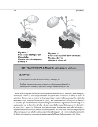 Apéndice A388
Figura A-17
Colocación esofágica del
Combitubo.
Ventilar a través del puerto
número 1.
Figura A-18
Colocación traqueal del Combitubo.
Ventilar a través
del puerto número 2.
DESTREZA OPCIONAL 8: Mascarilla Laríngea para Vía Aérea
OBJETIVOS
Al finalizar esta estación de destreza deberá ser capaz de:
1. Explicar los nueve puntos esenciales sobre el uso de este dispositivo.
2. Insertar correctamente la mascarilla laríngea para vía aérea (MLA).
La mascarilla laríngea se diseñó para usarse como una alternativa de la mascarilla para conseguir y
mantener el control de la vía aérea durante los procedimientos anestésicos de rutina en la sala de
quirófano. Debido a que no protege la vía aérea contra el vómito y la broncoaspiración, está hecho
para usarse en pacientes que han estado en ayuno y por lo tanto tienen el estómago vacío. Después
se encontró que era útil en situaciones de emergencia cuando no es posible la intubación y no se
puedeventilarconundispositivodebolsa-válvula-mascarilla.Lamascarillalaríngeaesotrodispositivo
de inserción a ciegas pero difiere de otros ya que nunca fue diseñado para sellar el esófago y
originalmentenoseconsideróparasuusoenemergencias.Noequivalealtuboendotraquealysólo
debeusarsecuandohanfalladolosintentosporintubarlatráqueayestácomprometidalaventilación.
Se deben recordar nueve puntos esenciales acerca de la Mascarilla Laríngea paraVíaAérea:
 