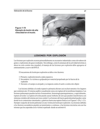 Valoración de la Escena 27
Figura 1-19
Ejemplo de lesión de alta
velocidad en el muslo.
LESIONES POR EXPLOSIÓN
Laslesionesporexplosiónocurrenprimordialmenteenescenariosindustrialescomoelevadoresde
granoyexplosionesdegasesresiduales.Sinembargo,comolaamenazadelaactividadterroristaes
ahora no solo común sino mundial, el manejo de las lesiones por explosión debe agregarse al
entrenamientoyacervodelBTLS.
El mecanismo de lesión por explosión se debe a tres factores:
1.Primario:explosióninicialuondaexpansiva
2. Secundario: la víctima es golpeada por material propulsado por la fuerza de la
explosión
3.Terciario: el cuerpo es arrojado y se impacta contra el suelo o contra otro objeto
Las lesiones debidas a la onda expansiva primaria afectan casi exclusivamente a los órganos
quecontienenaire.Elsistemaauditivousualmentecursaconrupturadelamembranatimpánica.Las
lesiones pulmonares pueden incluir el neumotórax, hemorragia parenquimatosa, y especialmente,
ruptura alveolar. La ruptura alveolar puede causar émbolos de aire que pueden manifestarse con
síntomasextrañosdelsistemanerviosocentral.Laslesionesdeltractogastrointestinalpuedenvariar
desde leves contusiones intestinales y gástricas hasta una ruptura franca (ver Figuras 1-20 y 1-21).
Siempresospechedelesiónpulmonarenunavíctimadelesiónporexplosión.Laslesionesdebidas
a los factores secundarios pueden ser penetrantes o contusas, y las lesiones terciarias son casi las
mismas que las esperadas en la víctima expulsada desde un automóvil.
 