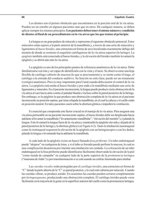 Capítulo Cuatro66
Los dientes son el primer obstáculo que encontramos en la porción oral de la vía aérea.
Pueden ser un estorbo en algunos pacientes más que en otros. De cualquier manera, se deben
aplicarsiemprelosmismosprincipios:Lospacientesdebentenerelmismonúmeroycondición
de dientes al final de un procedimiento en la vía aérea que los que tenían al principio.
La lengua es un gran pedazo de músculo y representa el siguiente obstáculo potencial. Estos
músculos están sujetos a la parte anterior de la mandíbula y, a través de una serie de músculos y
ligamentos al hueso hioides, una estructura en forma de arco localizada exactamente debajo del
mentón de donde se sostiene el esqueleto cartilaginoso de la vía aérea superior (la laringe). La
epiglotis también está conectada al hueso hioides, y la elevación del hioides también levantará la
epiglotis y se abrirá aún más la vía aérea.
La epiglotis es uno de los principales puntos de referencia anatómicos de la vía aérea. Debe
familiarizarse con éste y ser capaz de identificarlo con la vista y el tacto. Se observa como una hoja
flexible de cartílago cubierto de mucosa (lo que es precisamente) y se siente como el trago, el
cartílago a la entrada del conducto auditivo. Su función no está clara; puede ser un remanente
(vestigio) anatómico. Pero es muy importante para Usted cuando deba asumir el control de la vía
aérea. La epiglotis está unida al hueso hioides y por ende a la mandíbula mediante una serie de
ligamentosymúsculos.Enelpacienteinconsciente,lalenguapuedeproducirciertaobstruccióndela
vía aérea al caer hacia atrás contra el paladar blando e incluso sobre la pared posterior de la faringe.
Sin embargo, es la epiglotis la que produce una obstrucción completa de la vía aérea en el paciente
inconscienteenposiciónsupina,quetienerelajadalamandíbula,enelcuallacabezayelcuelloestán
en posición neutral. En tales pacientes caerá sobre la abertura glótica e impedirá la ventilación.
Es esencial que comprenda este factor crucial en el manejo de la vía aérea. Para asegurar una
víaaéreapermeableenunpacienteinconscientesupino,elhuesohioidesdebeserdesplazadohacia
adelanteallevantarlamandíbula(“levantamientomandibular”,“elevacióndelmentón”),ojalandola
lengua.Estolevantarálalenguafueradelavíaaéreaymantendrálaepiglotiselevadayalejadadela
pared posterior de la faringe y la abertura glótica (ver Figura 4-2).Tanto la intubación nasotraqueal
como la orotraqueal requieren la elevación de la epiglotis con un laringoscopio o con los dedos,
jalandolalenguaolevantandohaciaadelantelamandíbula.
A cada lado de la epiglotis existe un hueco llamado fosa piriforme. Un tubo endotraqueal
puede “alojarse” en cualquiera de éstas, y si el tubo es forzado puede perforar la mucosa, lo cual es
una complicación desastrosa por intentar una intubación sin cuidado. La colocación de un tubo
endotraqueal en la fosa piriforme puede identificarse fácilmente observando la elevación de la piel
“como tienda de campaña” en cualquier lado de la parte superior de la prominencia laríngea
(“manzanadeAdán”)oportransiluminaciónsiseestáusandounestileteiluminadoparaintubar.
Las cuerdas vocales están protegidas por el cartílago tiroides, una estructura en forma de
“C” donde la parte abierta de la “C” es pared posterior, y la cual está cubierta por músculo. Cuando
las cuerdas vibran, se produce sonido. En ocasiones las cuerdas pueden cerrarse completamente
por laringoespasmo, produciendo una obstrucción completa. El cartílago tiroides puede verse
fácilmenteenlamayoríadelagenteenlasuperficieanteriordelcuellocomolaprominencialaríngea.
 