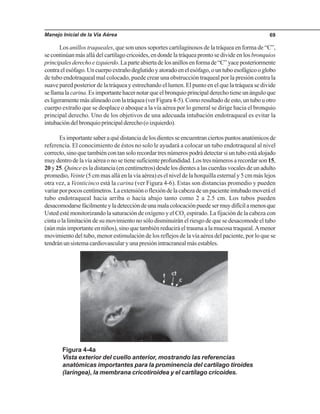 Manejo Inicial de la Vía Aérea 69
Los anillos traqueales, que son unos soportes cartilaginosos de la tráquea en forma de “C”,
se continúan más allá del cartílago cricoides, en donde la tráquea pronto se divide en los bronquios
principalesderechoeizquierdo.Laparteabiertadelosanillosenformade“C”yaceposteriormente
contraelesófago.Uncuerpoextrañodeglutidoyatoradoenelesófago,ountuboesofágicooglobo
de tubo endotraqueal mal colocado, puede crear una obstrucción traqueal por la presión contra la
suave pared posterior de la tráquea y estrechando el lumen. El punto en el que la tráquea se divide
sellamala carina.Esimportantehacernotarqueelbronquioprincipalderechotieneunánguloque
esligeramentemásalineadoconlatráquea(verFigura4-5).Comoresultadodeesto,untubouotro
cuerpo extraño que se desplace o aboque a la vía aérea por lo general se dirige hacia el bronquio
principal derecho. Uno de los objetivos de una adecuada intubación endotraqueal es evitar la
intubacióndelbronquioprincipalderecho(oizquierdo).
Esimportantesaberaquédistanciadelosdientesseencuentranciertospuntosanatómicosde
referencia. El conocimiento de éstos no solo le ayudará a colocar un tubo endotraqueal al nivel
correcto,sinoquetambiéncontansolorecordartresnúmerospodrádetectarsiuntuboestáalojado
muydentrodelavíaaéreaonosetienesuficienteprofundidad.Lostresnúmerosarecordarson15,
20 y25. Quinceesladistancia(encentímetros)desdelosdientesalascuerdasvocalesdeunadulto
promedio, Veinte (5 cm mas allá en la vía aérea) es el nivel de la horquilla esternal y 5 cm más lejos
otra vez, a Veinticinco está la carina (ver Figura 4-6). Estas son distancias promedio y pueden
variarporpocoscentímetros.Laextensiónoflexióndelacabezadeunpacienteintubadomoveráel
tubo endotraqueal hacia arriba o hacia abajo tanto como 2 a 2.5 cm. Los tubos pueden
desacomodarsefácilmenteyladeteccióndeunamalacolocaciónpuedesermuydifícilamenosque
Usted esté monitorizando la saturación de oxígeno y el CO2
espirado. La fijación de la cabeza con
cinta o la limitación de su movimiento no sólo disminuirán el riesgo de que se desacomode el tubo
(aún más importante en niños), sino que también reducirá el trauma a la mucosa traqueal.Amenor
movimiento del tubo, menor estimulación de los reflejos de la vía aérea del paciente, por lo que se
tendránunsistemacardiovascularyunapresiónintracranealmásestables.
Figura 4-4a
Vista exterior del cuello anterior, mostrando las referencias
anatómicas importantes para la prominencia del cartílago tiroides
(laríngea), la membrana cricotiroidea y el cartílago cricoides.
 