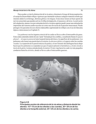 Manejo Inicial de la Vía Aérea 71
Para ayudar a evitar la obstrucción de la vía aérea y disminuir el riesgo de broncoaspiración,
elcuerpohadesarrolladoreflejosvigorososqueintentaránrechazarcualquiermaterialextrañoque
intenten dañar la orofaringe, abertura glótica o la tráquea. Estas áreas tienen un buen aporte de
nerviossensorialesquepuedenactivarelreflejodedeglución,elnauseosoydelatos.Laactivación
deladeglución,náuseaotosporestimulacióndelavíaaéreasuperiorpuedecausarunaestimulación
importante del sistema cardiovascular así como una elevación de la presión intracraneal. Puede
protegeralospacientesdeesosefectosindeseablessuprimiendolosreflejosconelusodelidocaína
tópica o intravenosa (ver Capítulo 5)
Los pulmones son los órganos a través de los cuales se lleva a cabo el intercambio de gases.
Estosestáncontenidosdentrodeuna“jaula”formadaporlascostillas,yusualmentellenanelespacio
pleural — el espacio potencial entre la pared interna del tórax y la superficie de los pulmones. Los
pulmones solo tienen una puerta hacia el exterior, la abertura glótica, el espacio entre las cuerdas
vocales. La expansión de la pared torácica (la jaula) y el movimiento del diafragma hacia abajo
hacen que los pulmones se expandan (ya que el espacio pleural es hermético), y el aire circula a
través de la glotis, la única entrada desde el exterior. El aire viaja hacia los cada vez más pequeños
conductos hasta los alvéolos, donde se lleva a cabo el intercambio gaseoso.
Figura 4-6
Principales puntos de referencia de la vía aérea y distancia desde los
dientes: 15 = 15 cm de los dientes a las cuerdas, 20 = 20 cm de los
dientes a la horquilla esternal, 25 = 25 cm de los dientes a la carina.
 