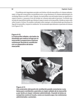 Capítulo Cuatro82
Elproblemamásimportanteasociadoconlabolsa-válvula-mascarillaeselvolumenadminis-
trado.Lafugadelamascarillaesunproblemaserio,yaquedisminuyeelvolumenadministradoala
orofaringe hasta en un 40% o más.Además, las mascarillas convencionales tienen un significativo
espacio muerto, y aumenta el reto de brindar un volumen adecuado al paciente. Un diseño más
recientedemascarilladegloboqueeliminaelespaciomuertoenlamascarillaybrindaunmejorsello
sobre la nariz y la boca. En estudios realizados sobre maniquí, se ha demostrado que disminuye la
fugadelamascarillaymejoralaventilación.Serecomiendaespecialmenteenpacientesdetrauma
(ver Figura 4-12).
Figura 4-12
La mascarilla inflable o de balón ha
mostrado que reduce la fuga por la
mascarilla y proporciona mayores
volúmenes durante la ventilación
con un dispositivo de bolsa-
mascarilla.
Figura 4-13
Una extensión del puerto de ventilación puede conectarse a una
bolsa para ventilación y permite un mejor sellado de la mascarilla
y por tanto un mayor volumen administrado. Cuando la bolsa se
comprime contra el muslo, como se muestra aquí, los volúmenes
administrados aumentan.
 
