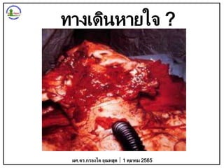ทางเดินหายใจ ?
ผศ.ดร.กรองได อุณหสูต 1 ตุลาคม 2565
 
