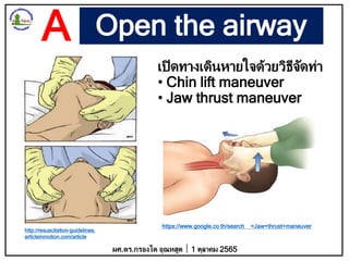 Open the airway
เปิดทางเดินหายใจด้วยวิธีจัดท่า
• Chin lift maneuver
• Jaw thrust maneuver
ผศ.ดร.กรองได อุณหสูต 1 ตุลาคม 2565
A
http://resuscitation-guidelines.
articleinmotion.com/article
https://www.google.co.th/search =Jaw+thrust+maneuver
 