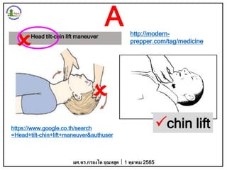 https://www.google.co.th/search
=Head+tilt-chin+lift+maneuver&authuser
http://modern-
prepper.com/tag/medicine
chin lift
Head tilt-chin lift maneuver


ผศ.ดร.กรองได อุณหสูต 1 ตุลาคม 2565
A
 