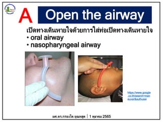 Open the airway
เปิดทางเดินหายใจด้วยการใส่ท่อเปิดทางเดินหายใจ
• oral airway
• nasopharyngeal airway
ผศ.ดร.กรองได อุณหสูต 1 ตุลาคม 2565
A
https://www.google
.co.th/search=man
euver&authuser
 