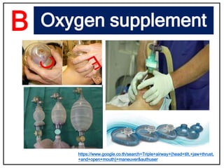 Oxygen supplement
https://www.google.co.th/search=Triple+airway+(head+tilt,+jaw+thrust,
+and+open+mouth)+maneuver&authuser
B
 