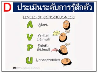 ประเมินระดับการรู้สึกตัว
D
 