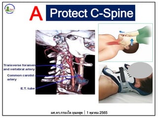 Protect C-Spine
ผศ.ดร.กรองได อุณหสูต 1 ตุลาคม 2565
A
 