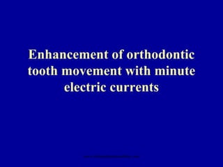 Enhancement of orthodontic
tooth movement with minute
electric currents
www.indiandentalacademy.com
 