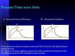 B to A Mechanical Ventilation good lecture.ppt