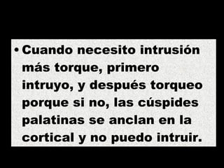 Cuando necesito intrusión más torque, primero intruyo, y después torqueo porque si no, las cúspides palatinas se anclan en la cortical y no puedo intruir. 