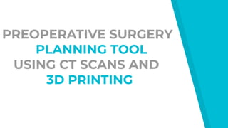 PREOPERATIVE SURGERY
PLANNING TOOL
USING CT SCANS AND
3D PRINTING
 